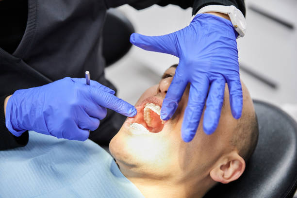 Best Knocked-Out Tooth (Avulsed Tooth) Treatment in Garrett, WA