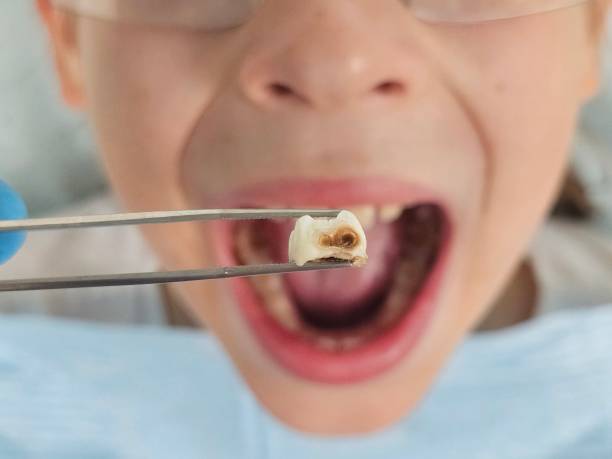 Best Urgent Dental Care for Toothaches in Garrett, WA